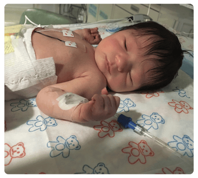 Newborn baby sleeping in a hospital bassinet with medical monitoring leads attached.