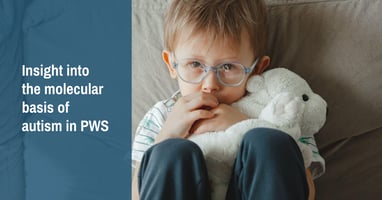 baby-teeth-cells-give-insight-on-the-molecular-basis-of-autism-in-pws