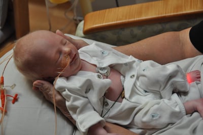its-a-decade-of-declan-1-newborn-baby-with-tube