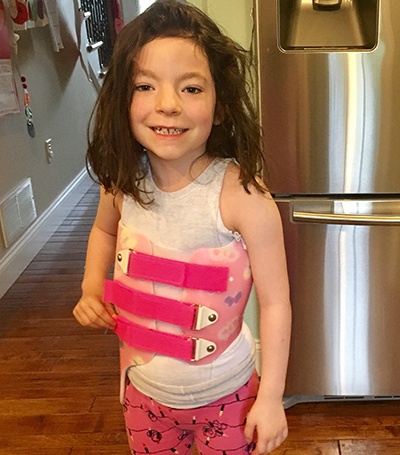 orthopedic-issues-and-prader-willi-syndrome-qa-with-dr-van-bosse-1.jpg