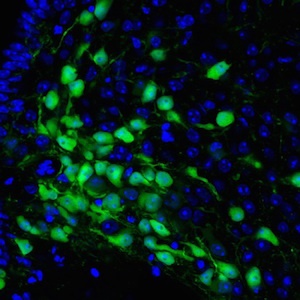 role-of-magel2-in-feeding-and-energy-is-focus-of-fpwr-funded-study.jpg