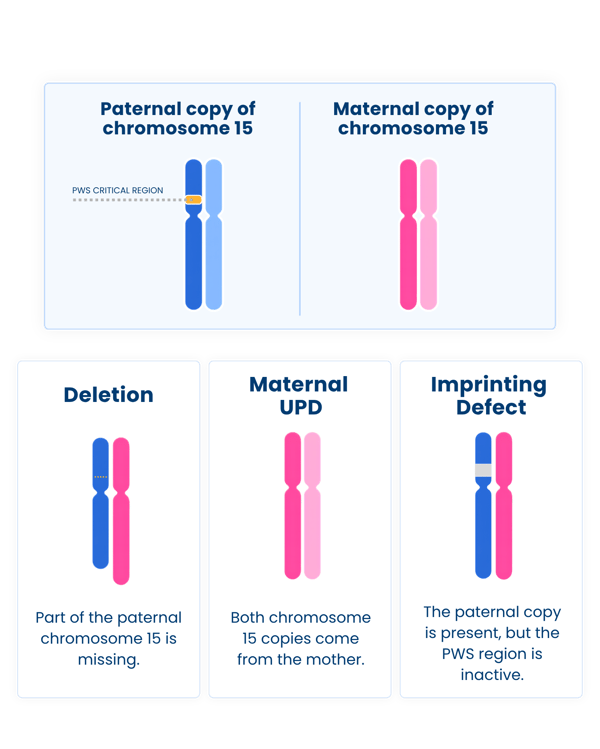 Diagram showing three genetic causes of Prader-Willi syndrome: paternal chromosome 15 deletion, maternal uniparental disomy (UPD), and an imprinting defect.