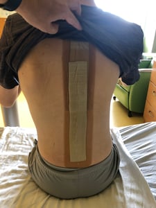 Long bandage covering surgery incision
