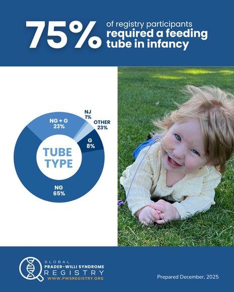 Infographic showing that 75% of Global PWS Registry participants required a feeding tube in infancy, alongside a photo of a smiling baby with a nasal feeding tube.