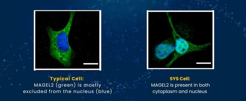 MAGEL2 Mislocalization and What It Means for SYS Research