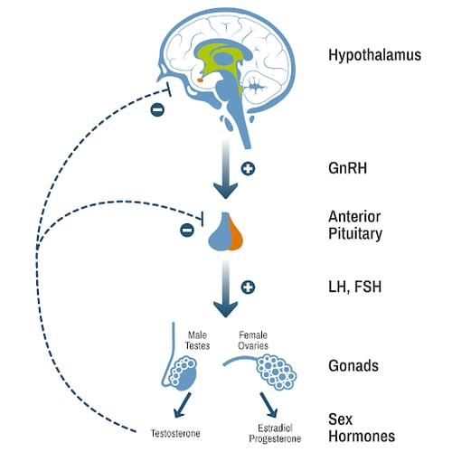 hypogonadism-process