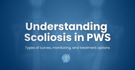Understanding Scoliosis in Prader-Willi Syndrome: From Early Curves to Surgical Decisions
