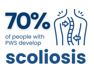 scoliosis occurance