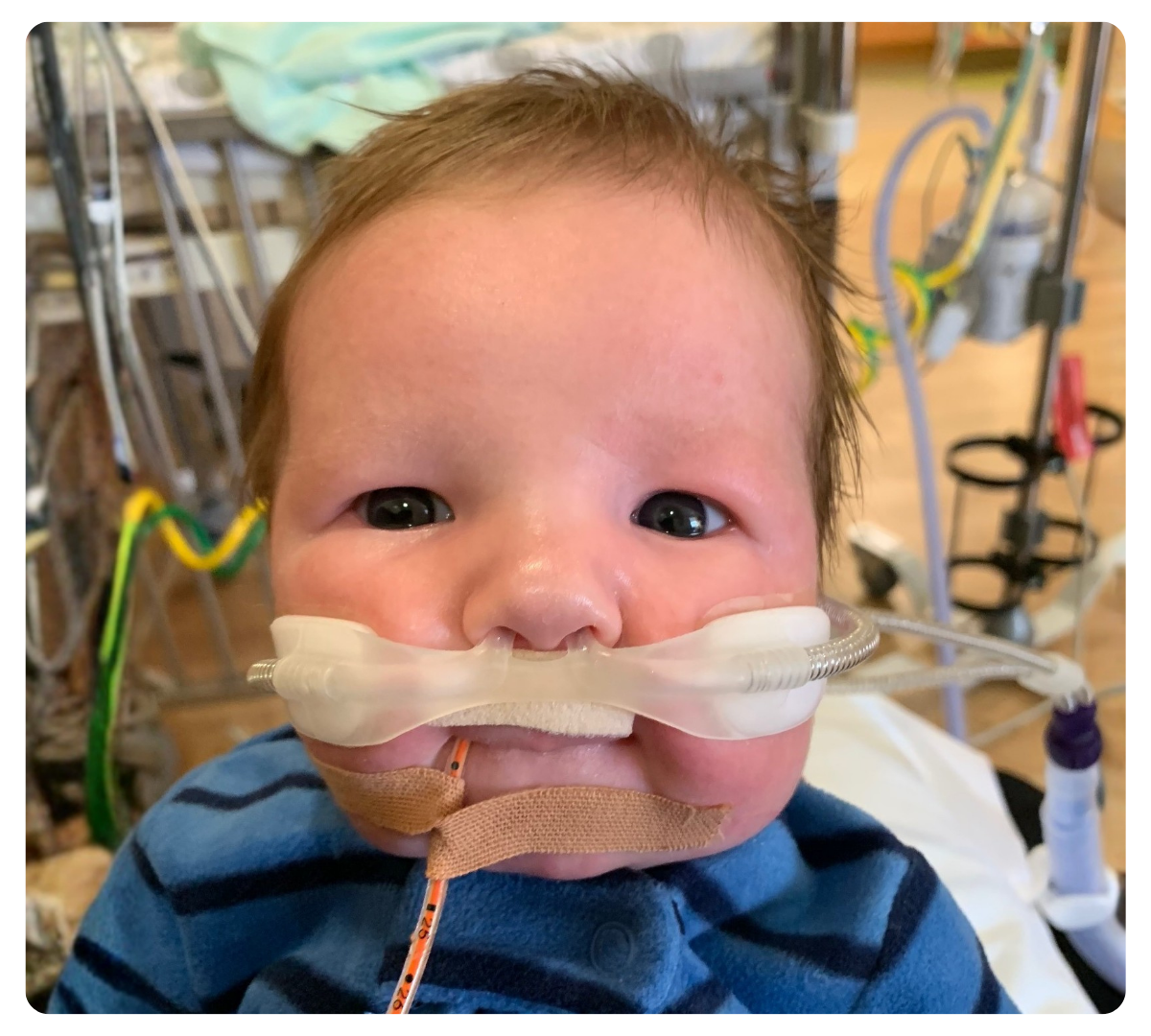 NICU baby