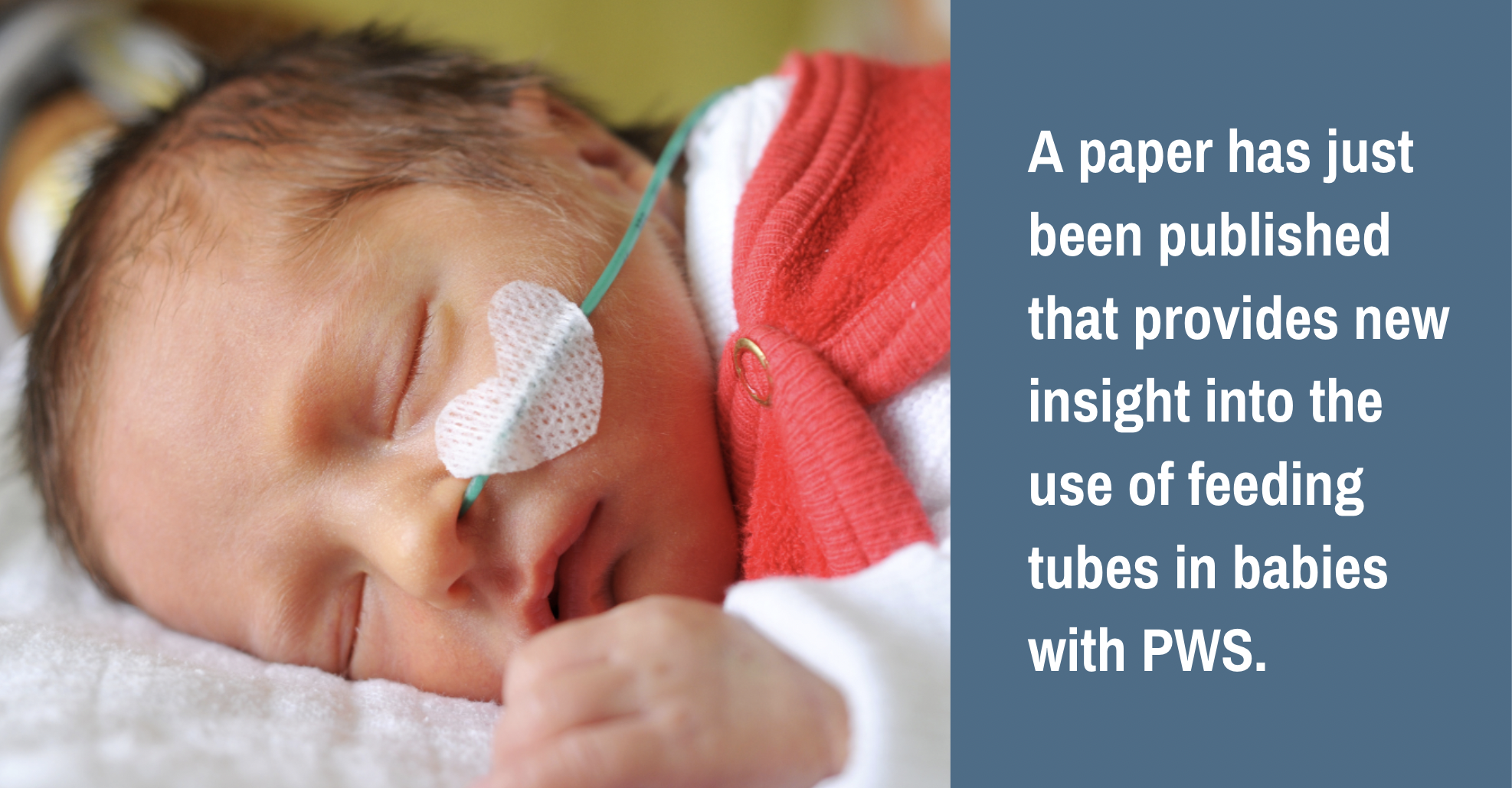 Feeding Tube Use and Complications in Babies With PWS