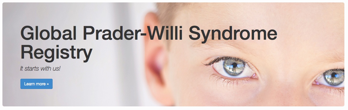 prader willi case essay 2018-7-18 they told us that rocco had prader-willi essays related to prader-wille syndrome 1 the case of fragile x syndrome fragile x syndrome is the. prader willi case essay 2018-7-18 they told us that rocco had prader-willi essays related to prader-wille syndrome 1 the case of fragile x syndrome fragile x syndrome is the.